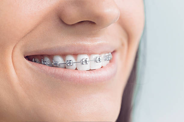 Best Root Canal Treatment  in Bossier City, LA